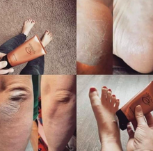 Load image into Gallery viewer, Epoch® Sole Solution® Foot Treatment