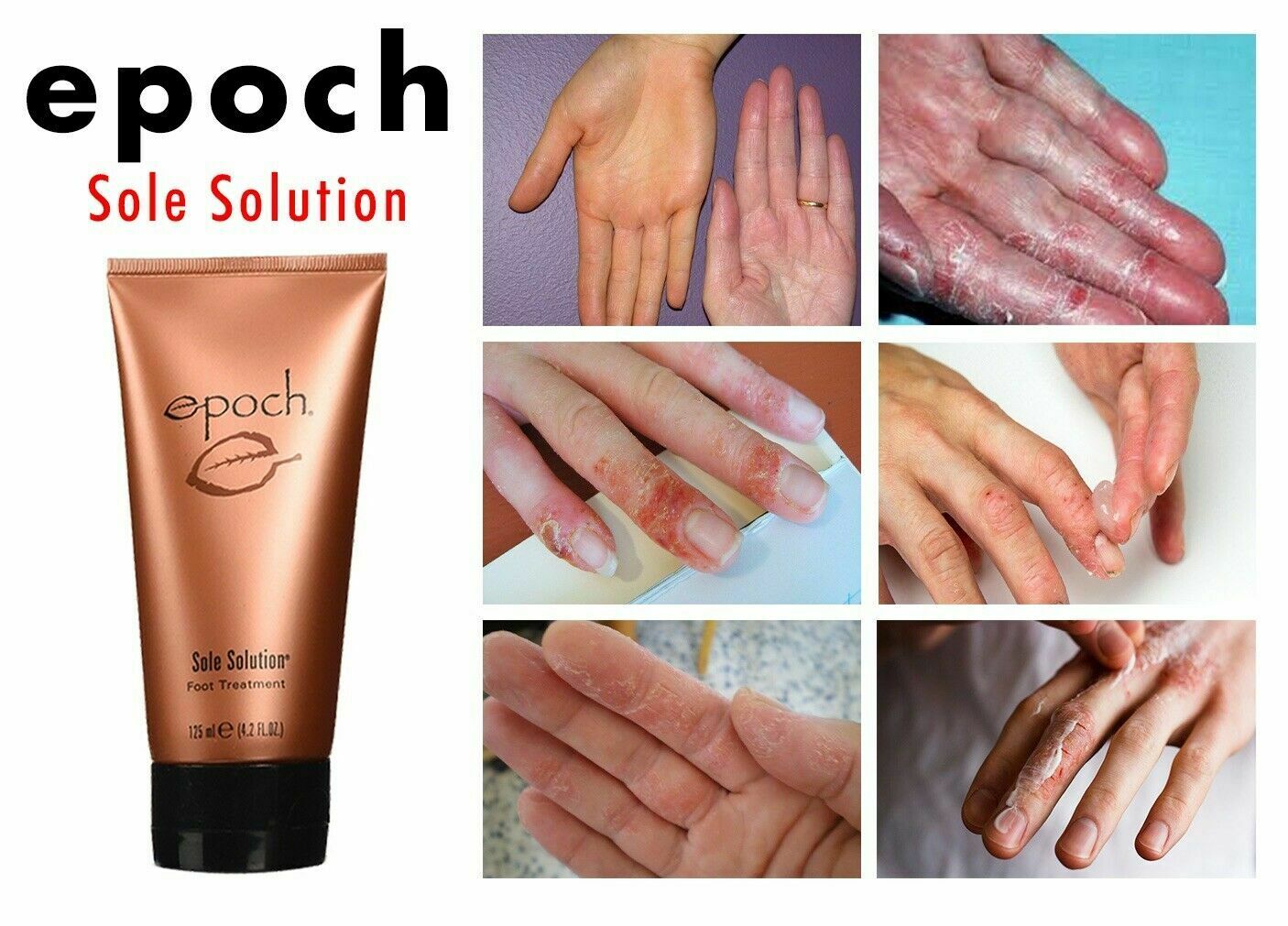 Epoch sales sole solution